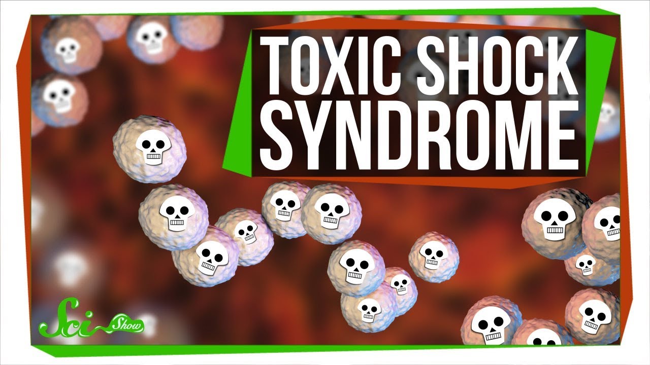 Toxic Shock Syndrome (TSS) - EMCrit Project