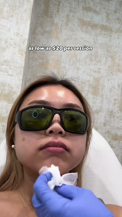 laser hair removal ISN’T expensive?! (shocked)