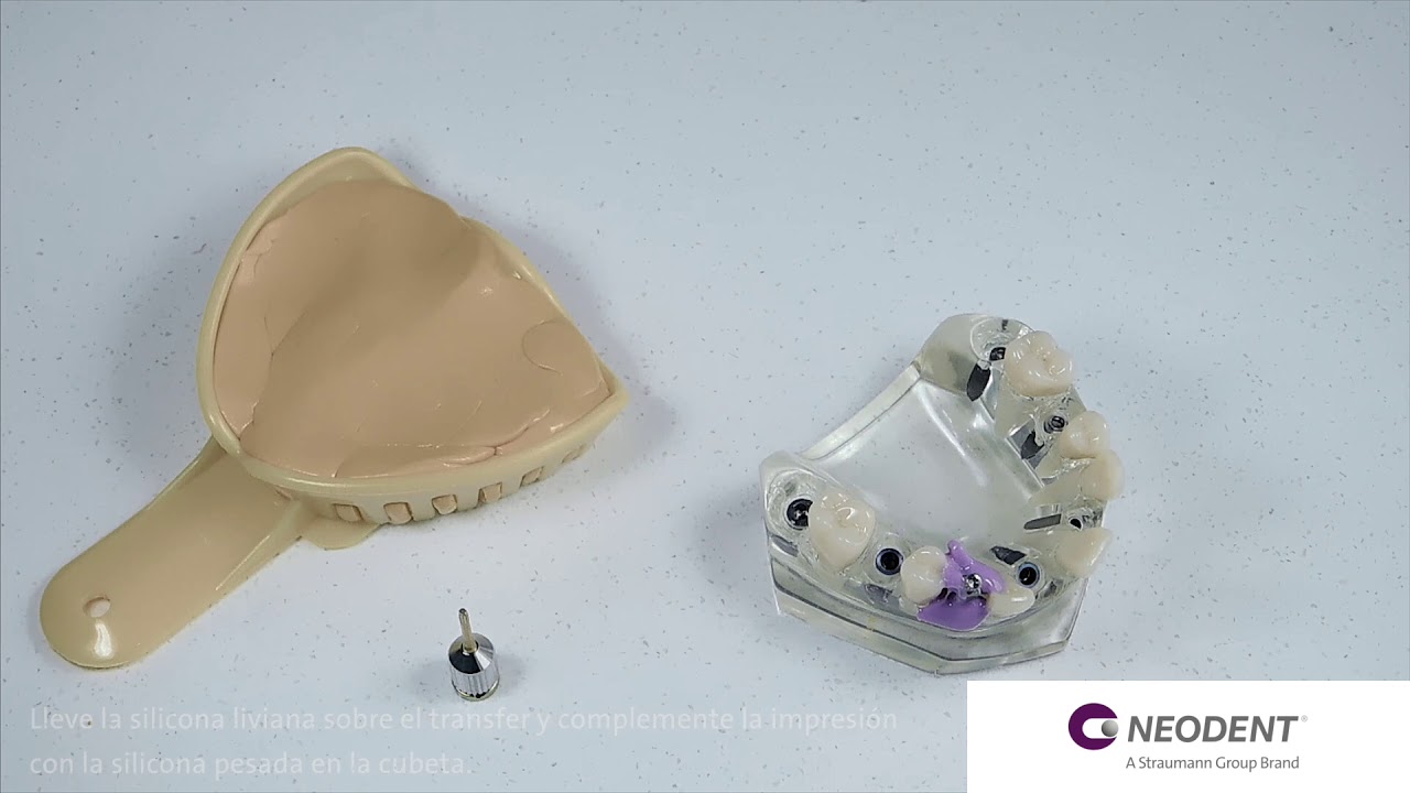 Toma de impresión cubeta abierta implante Helix Grand Morse - YouTube