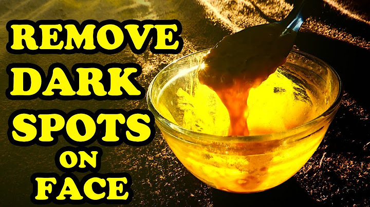 How to remove dark spots on face home remedies