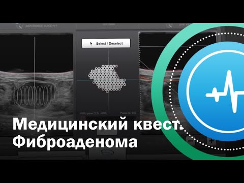 Медицинский квест. Фиброаденома