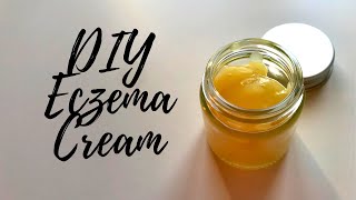 DIY Eczema Cream