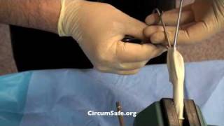 The Circumsafe Method