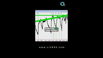 Boost Your Brain Function with LiveO2 BrainO2 🧠