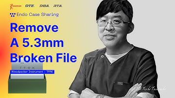 【Case Sharing】-Remove A 5.3mm Broken File (by Dr. Yoshi Terauchi) - TFRK