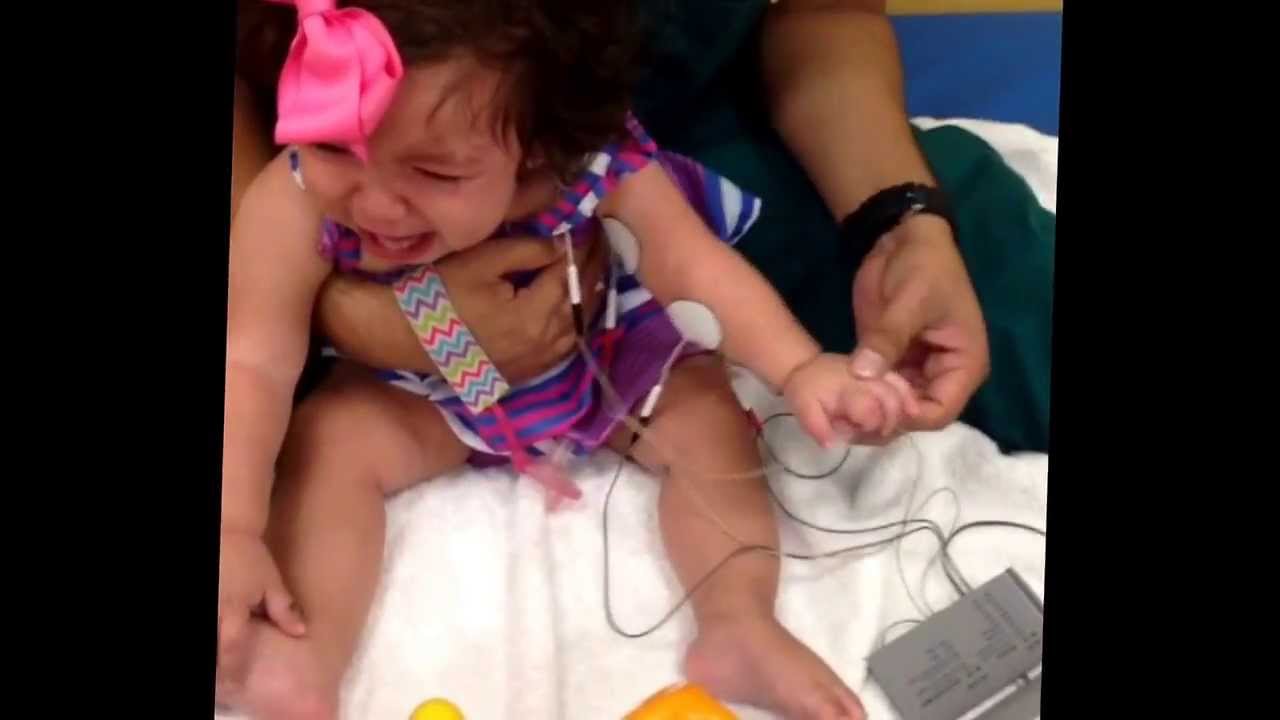 Getting therapy with the NMES machine ... Erbs palsy baby - YouTube