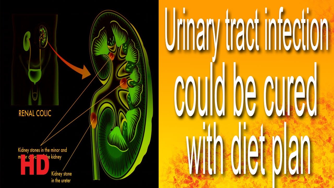 Urine Infection Diet Chart