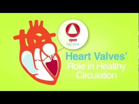 heart-valves-are-for-life