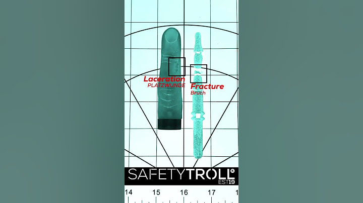 //TROLLFINGER VS. CARDOOR\\