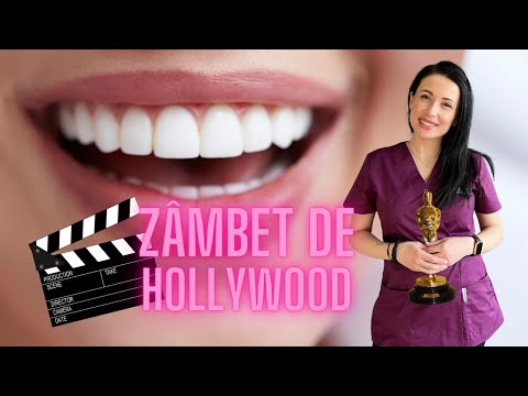 Zâmbet de Hollywood: Secretele Dinților Albi și Sfaturi de Îngrijire Orală