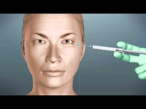 Wideo: Francisca Lachapel Wstrzykuje Sobie Botox W Twarz