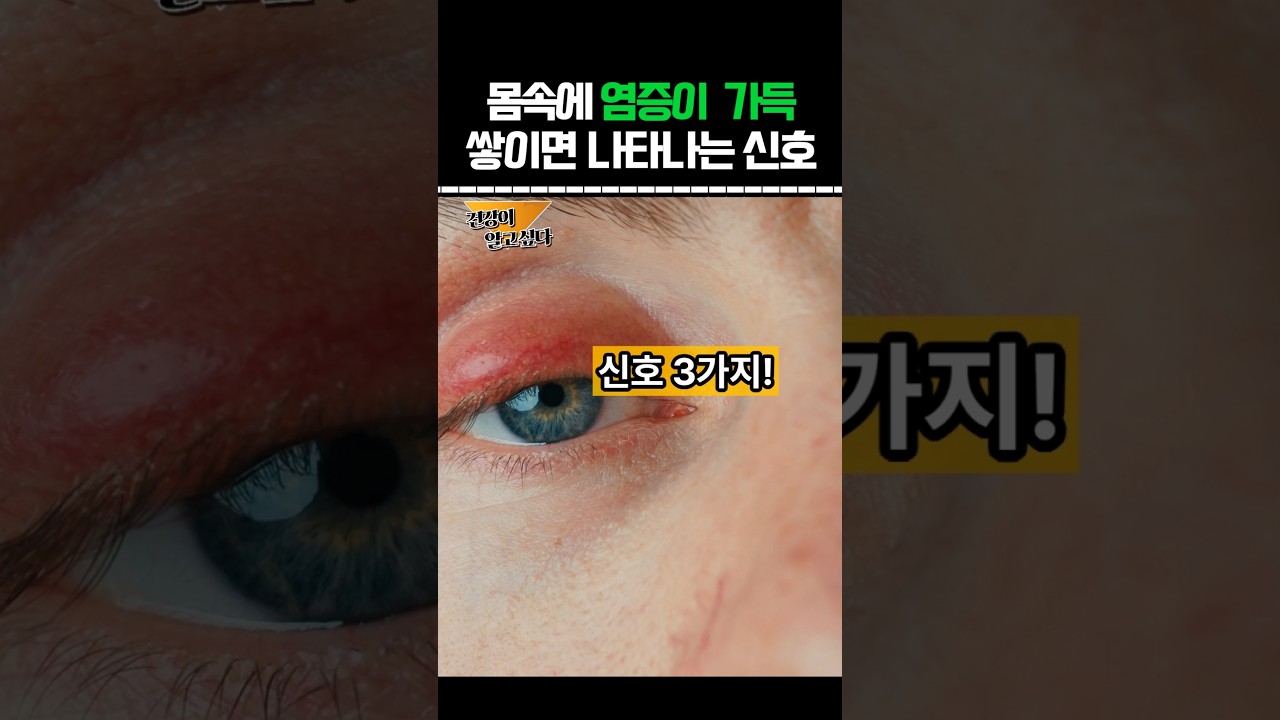 몸속에 염증이 가득 쌓이면 나타나는 염증신호 #건강정보 #음식