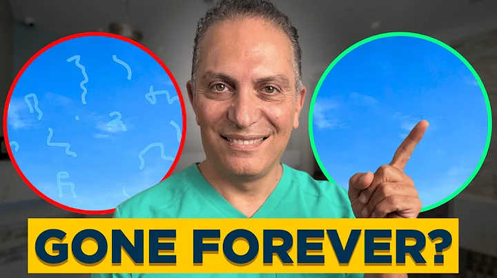 How to get rid of Eye Floaters? | EYE DOCTOR ADVICE