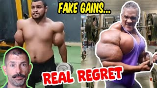 Unbelievable Synthol Fails - Fake Muscle Madness