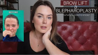 BROW LIFT \& BLEPHAROPLASTY: ONE YEAR UPDATE AND WHAT YOU NEED TO KNOW