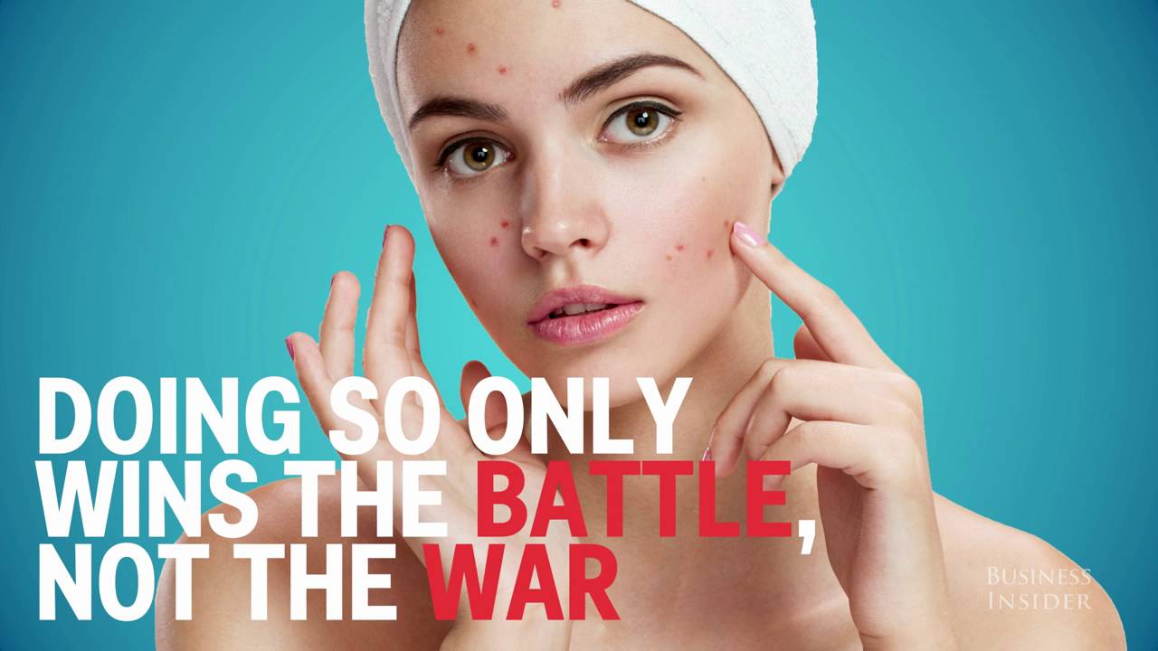 The Science Behind Why You Should Never Pop A Pimple Youtube