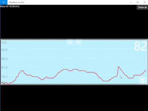 ChartControl