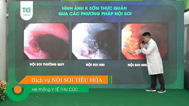 Nội soi thực quản hết bao nhiêu tiền năm 2024