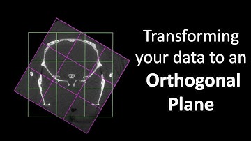 Transforming Data to Orthogonal Planes   [3D Slicer Workflow]