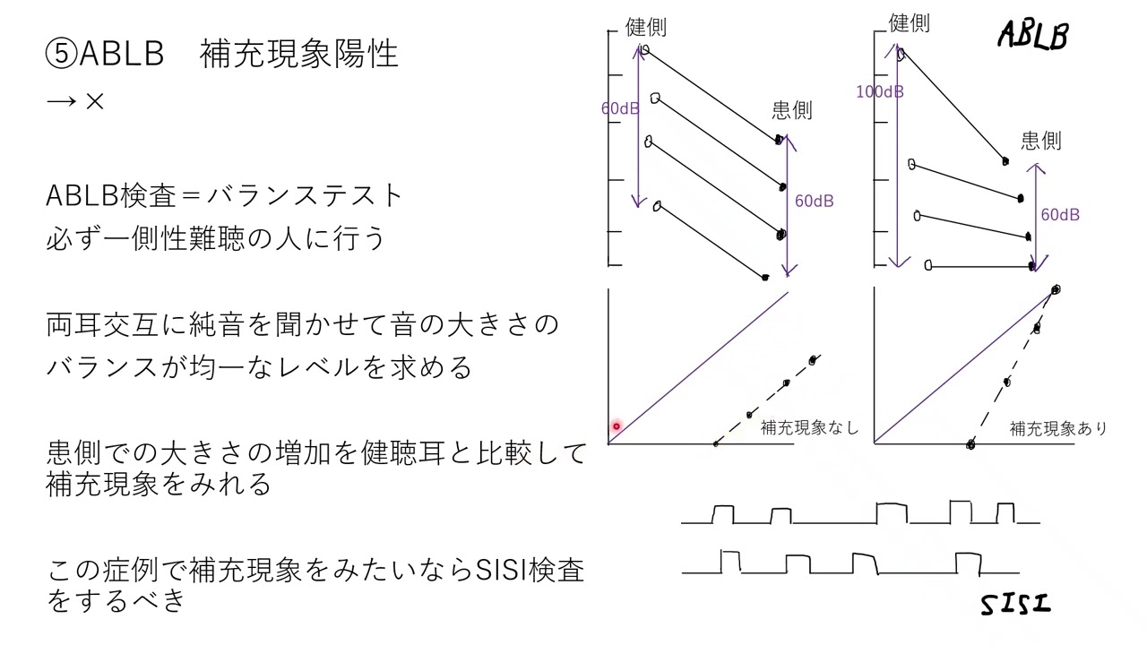 言語聴覚士国家試験　第27回　午前94　オージオグラム