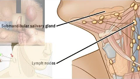 Understanding and Detecting Cancerous Lymph Nodes: A Comprehensive Guide