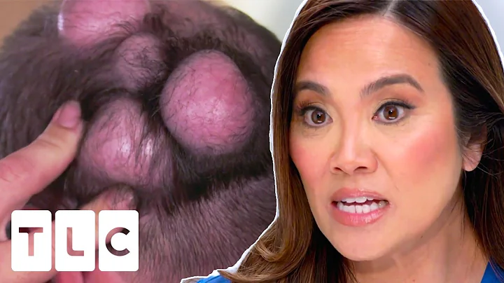 Dr. Sandra Lee Sees Patient With EIGHT BUMPS On His Head | Dr. Pimple Popper