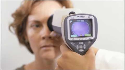 Smartscope PRO with EY4 - Imaging technique