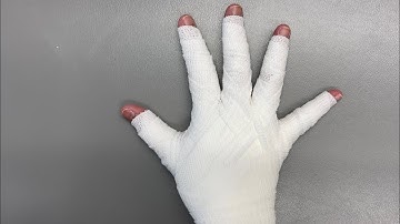 Bandage your right fingers and hand on your own.