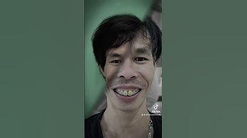 Lột xác ngoạn mục sau niềng răng hô ở người lớn tuổi | #short