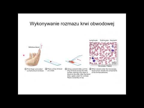 Wideo: Czy diapedeza i chemotaksja to to samo?