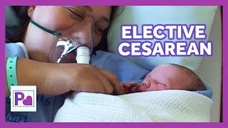 Can You Elect To Have A Cesarean? | Baby's Birth Day | S1 EP20