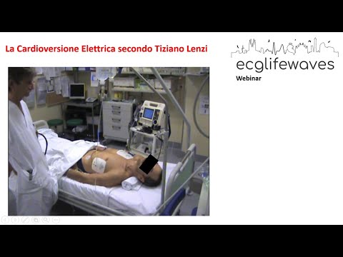 La Cardioversione Elettrica secondo Tiziano Lenzi - ECGLIFEWAVES Webinar