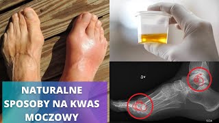 Obniż KWAS MOCZOWY naturalnymi produktami - Najlepsze domowe sposoby