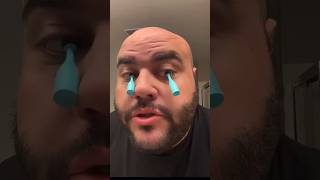 7MY EYEBALL FELL OUT