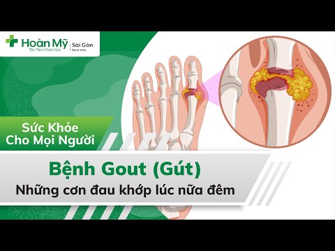 Bệnh Gout (Gút) | Gout là gì? Phát hiện sớm và Điều trị khỏi