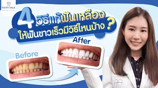 4 วิธีแก้ฟันเหลืองมีวิธีไหนบ้าง 