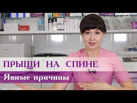 Прыщи на спине.  Явные причины.