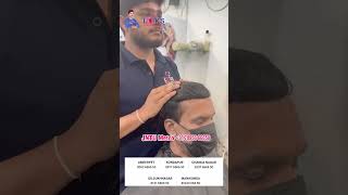 Instant Hair Replacement Results That Look 100% Natural
