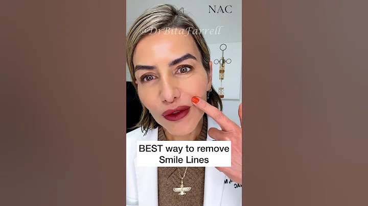 #smilelines #nasolabislfoldsfillers #nasolabialfolds #filler #fillertraining #drbitafarrell