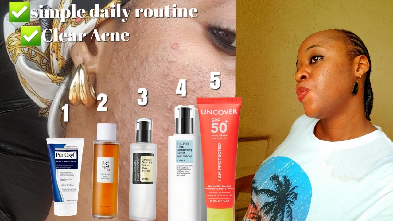 Simple Morning Skincare routine for my Acne Prone Skin - YouTube