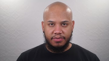 Kel: Before + After Scalp Micro Pigmentation at The Scalp Shop