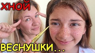 ВЕСНУШКИ ХНОЙ😜жесть😜ПРАНК над Liza Nice ❤️пранк над собой❤️😭💓😭