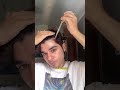 Minoxidil 5% Solution 💇♂️ | Hair Growth & Hair Fall Control | Zeelab Pharmacy