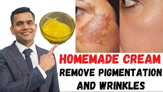 ONE SOLUTIONS FOR ALL SKIN PROBLEMS. Cream To Remove Pigmentation And Wrinkles- Dr.Vivek Joshi