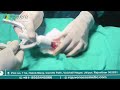 ZSR Circumcision in Jaipur | Painless &amp; Stitchless Surgery by Dr Deepesh Goyal | Rejuvena Cosmo Care