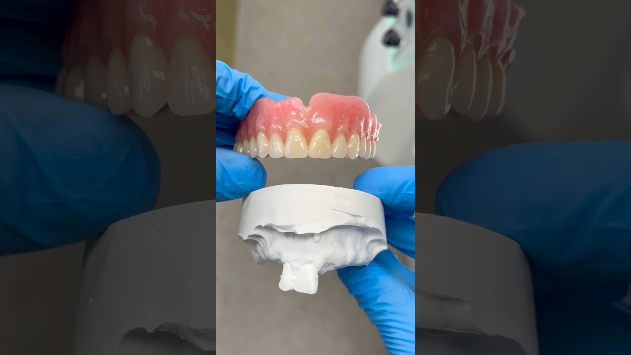 Ready for a new smile 