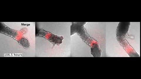 Somite formation in gastruloids