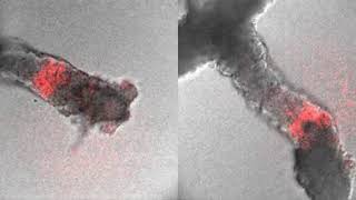 Somite formation in gastruloids