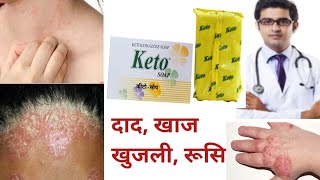 Keto Soap Uses,Benefits Side Effects | Ketoconazole | कीटो साबुन के फायदे, नुकसान और लगाने का तरीका screenshot 1