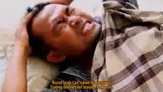 Cae Aceh Penyaket